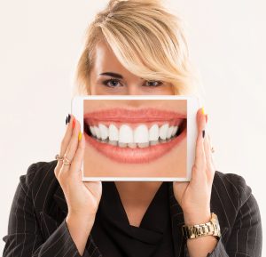 Hollywood smile w Turcji
